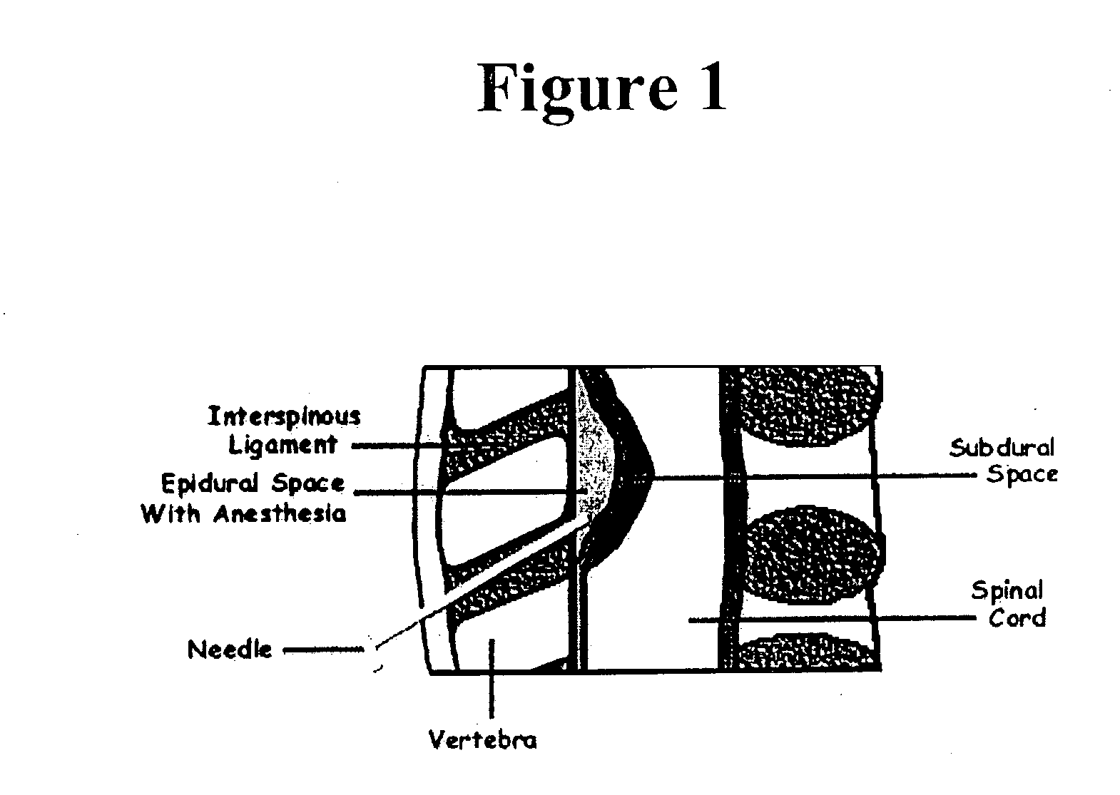 Methods and kits for detecting cerebrospinal fluid in a sample