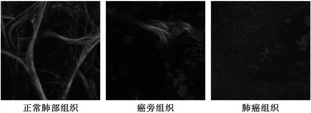 Detection method based on reduction of lung self-fluorescence as mark for detecting lung cancer tissue and application thereof