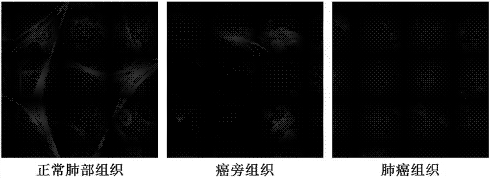 Detection method based on reduction of lung self-fluorescence as mark for detecting lung cancer tissue and application thereof