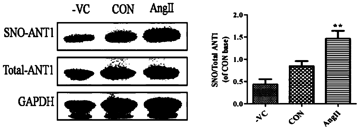 Application of a kind of adenine nucleotide transporter 1