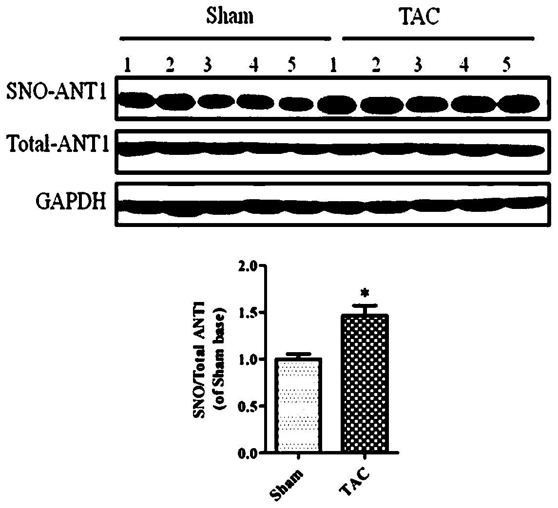 Application of a kind of adenine nucleotide transporter 1