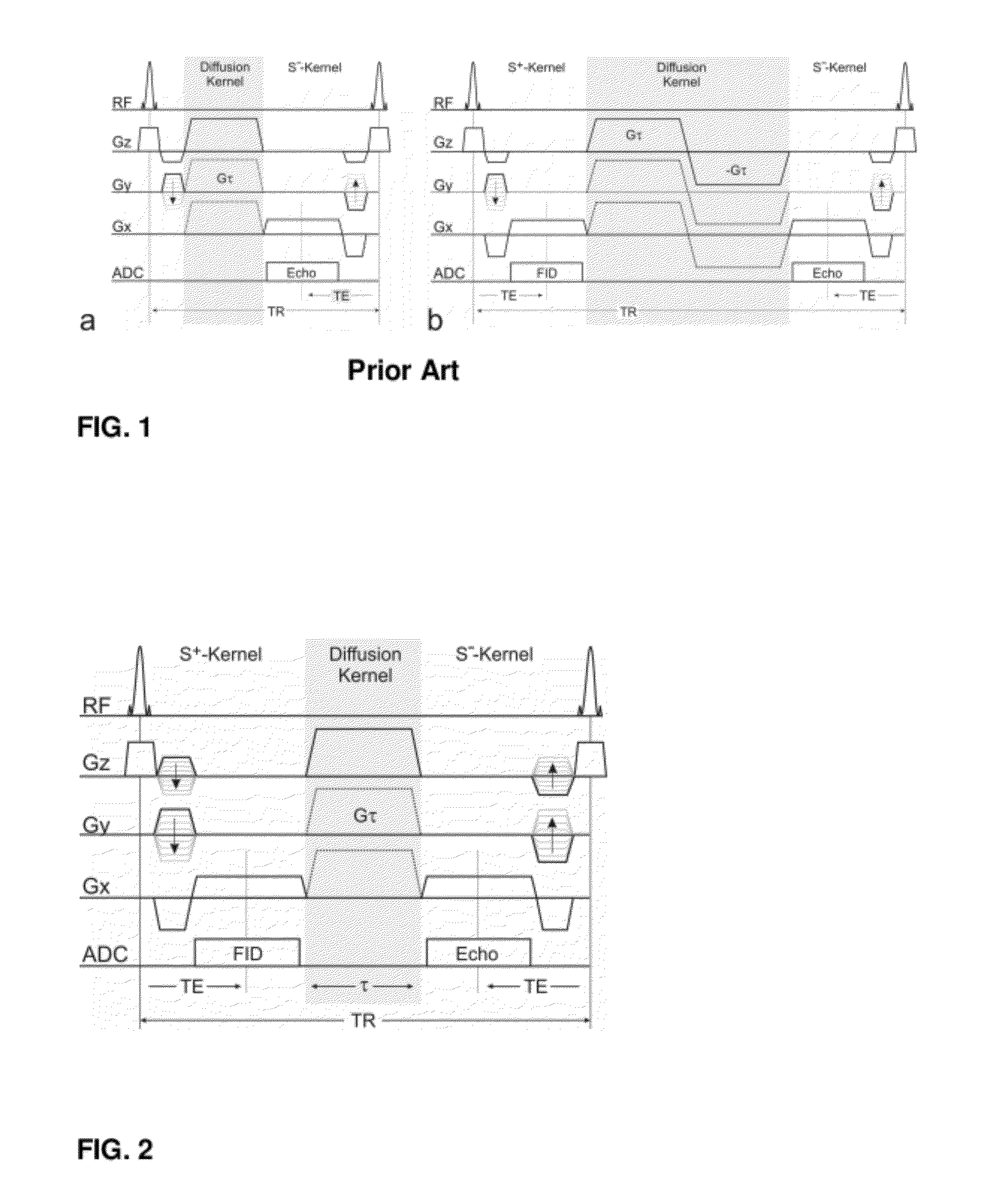 Magnetic resonance method for quantification of molecular diffusion using double echo steady state sequences