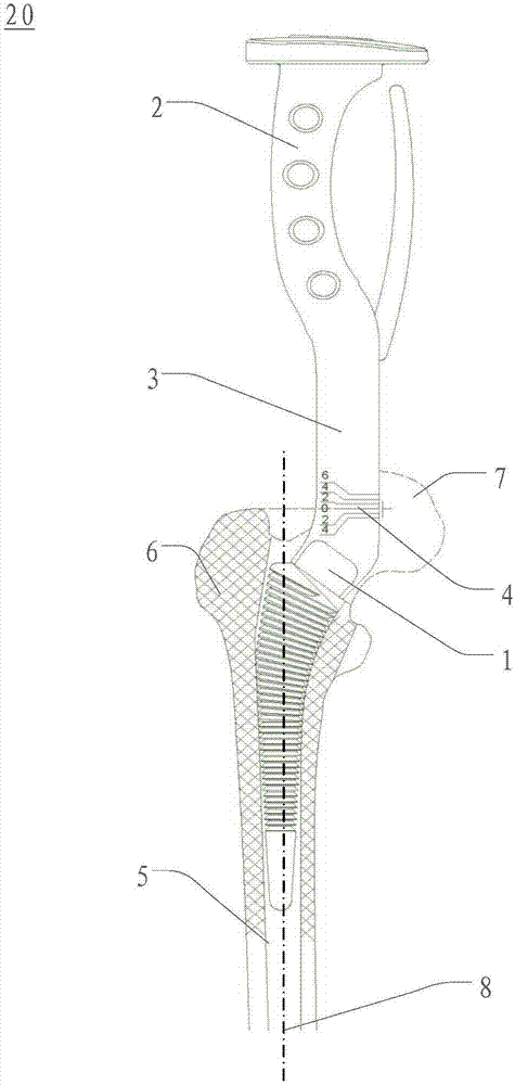 File handle and file for total hip replacement arthroplasty