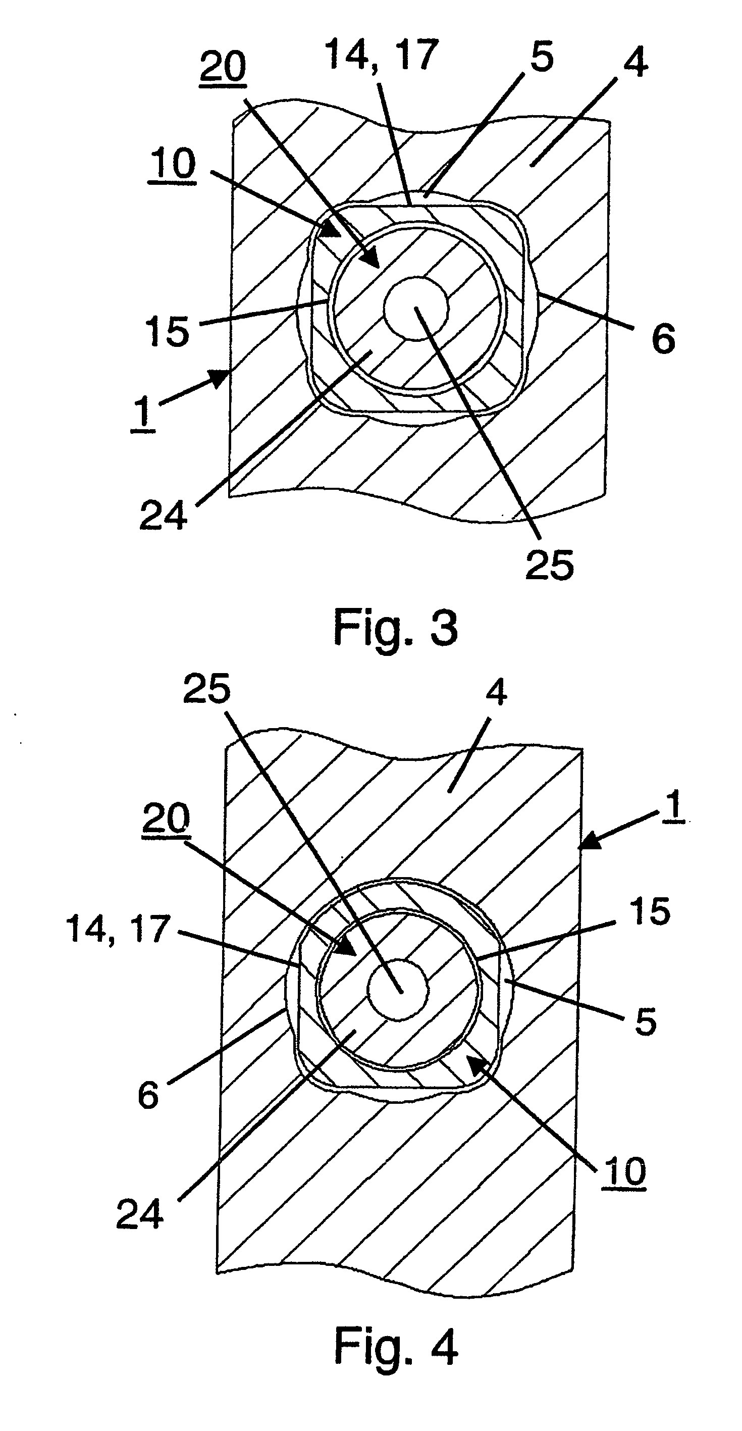 Device for the treatment of femoral fractures