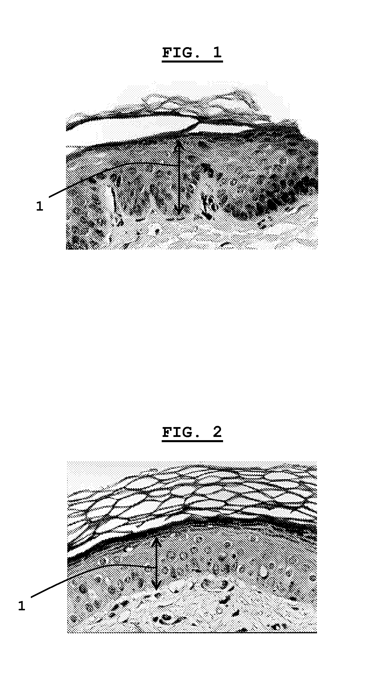 Dermocosmetic composition, aesthetic treatment method using the composition, and use of the composition for lightening the pigmentation of the skin