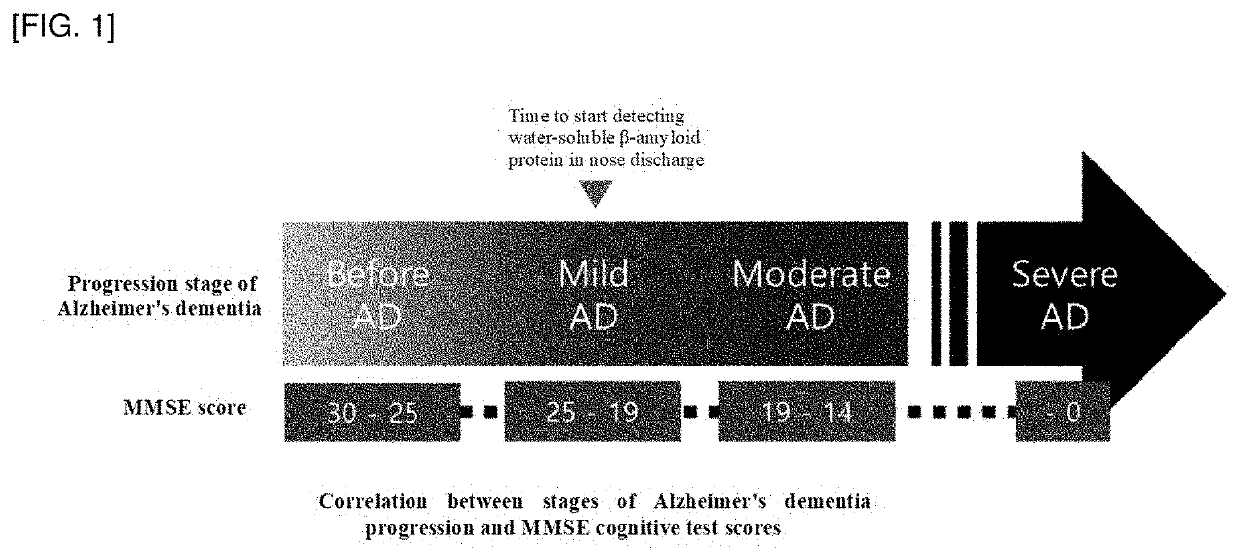 Composition for screening ongoing progress of alzheimer's disease by using beta amyloid oligomer in nasal discharge specimen and method for screening ongoing progress of alzheimer's disease by using same