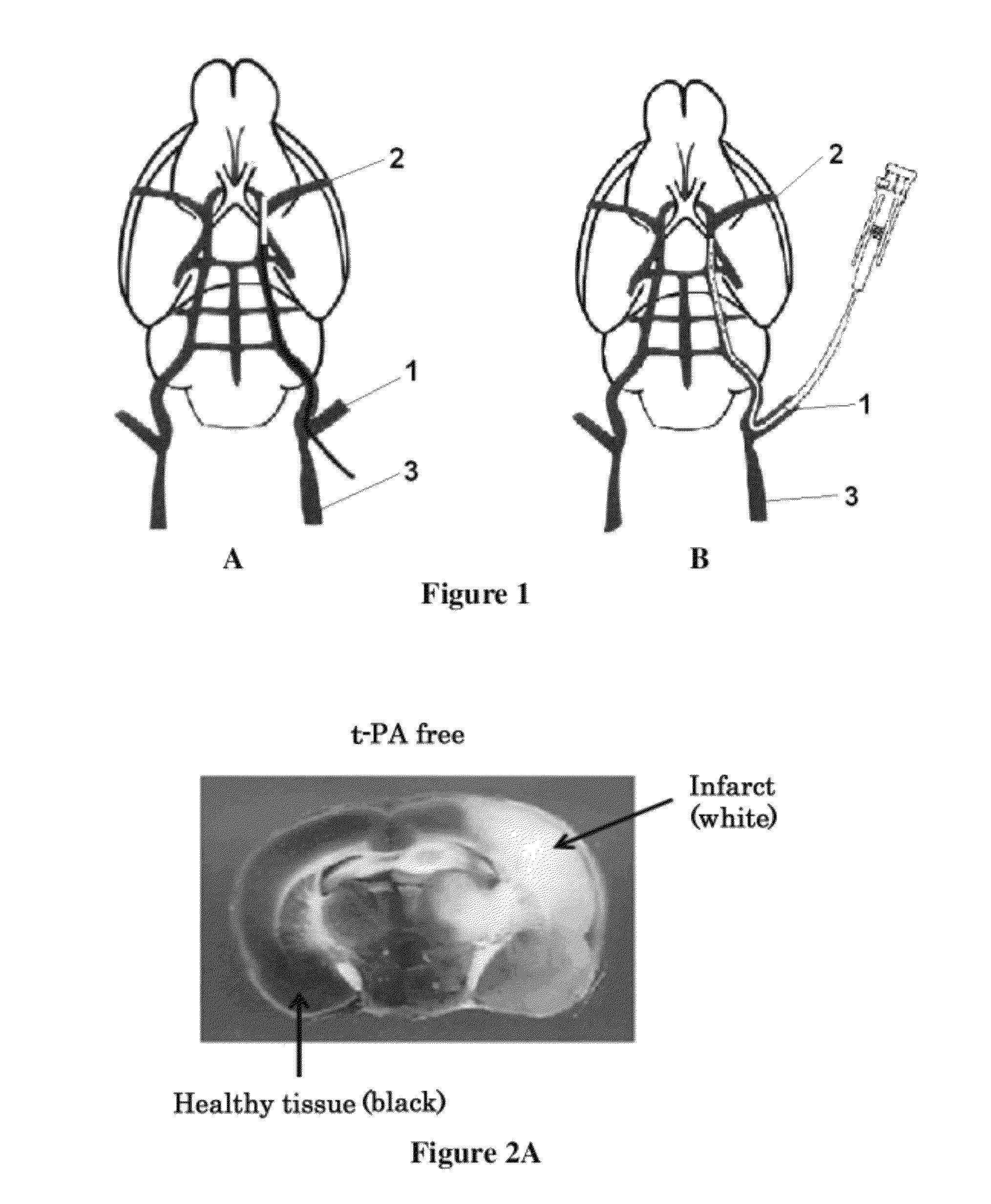 Pharmaceutical composition for treating ischemic events