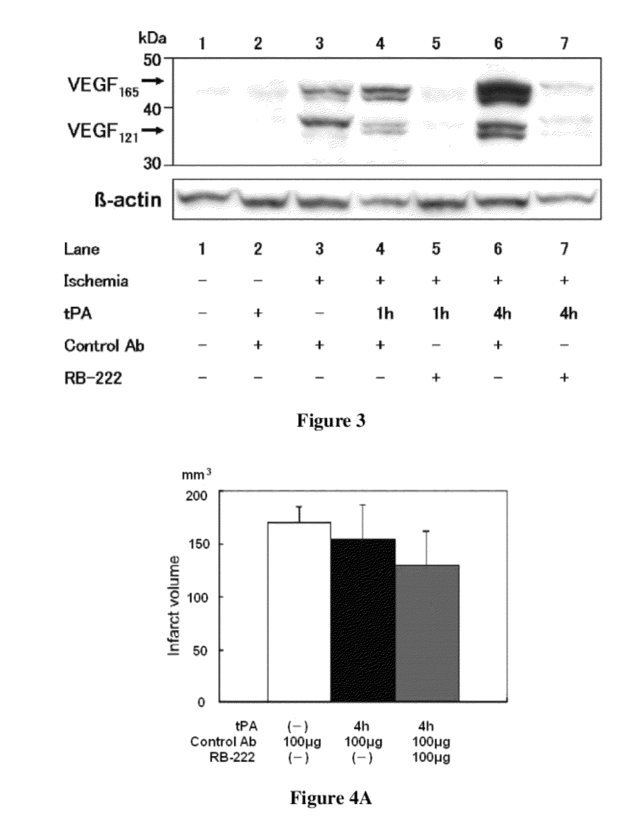 Pharmaceutical composition for treating ischemic events