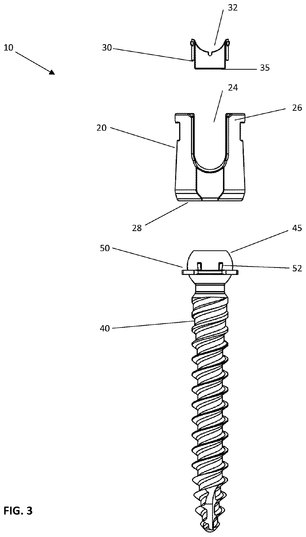 Modular polyaxial pedicle screw assembly with split ring
