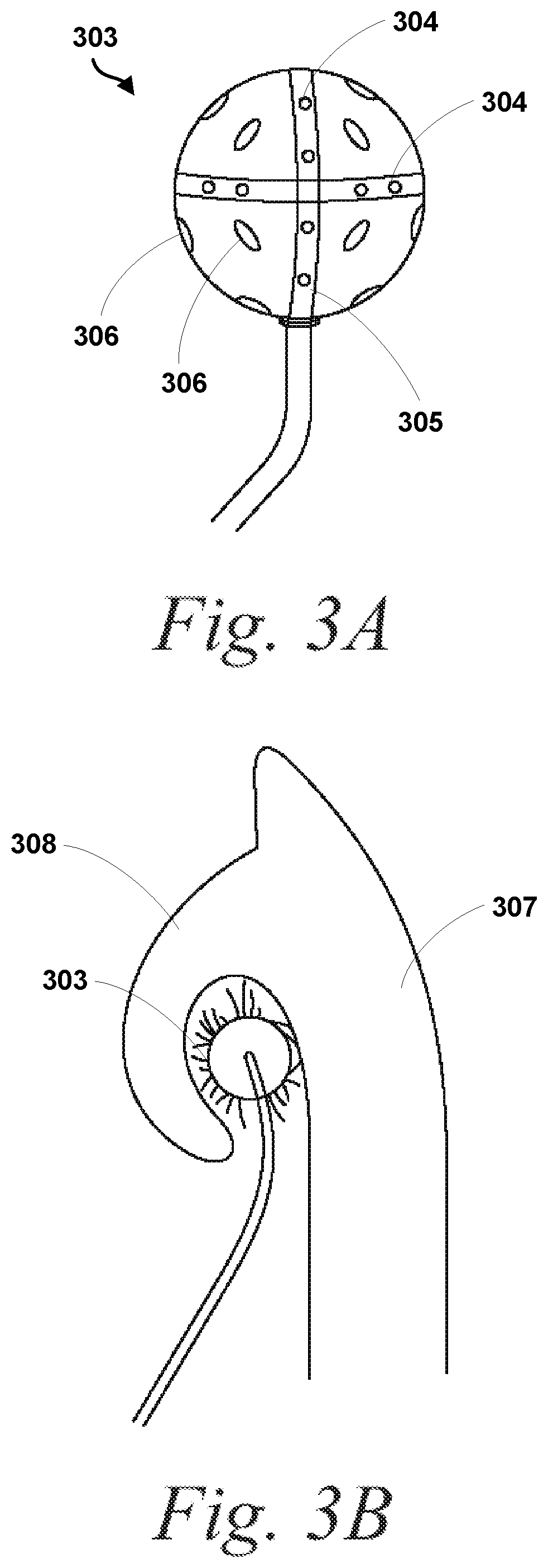 Systems and Methods for Improved Treatment of Headache