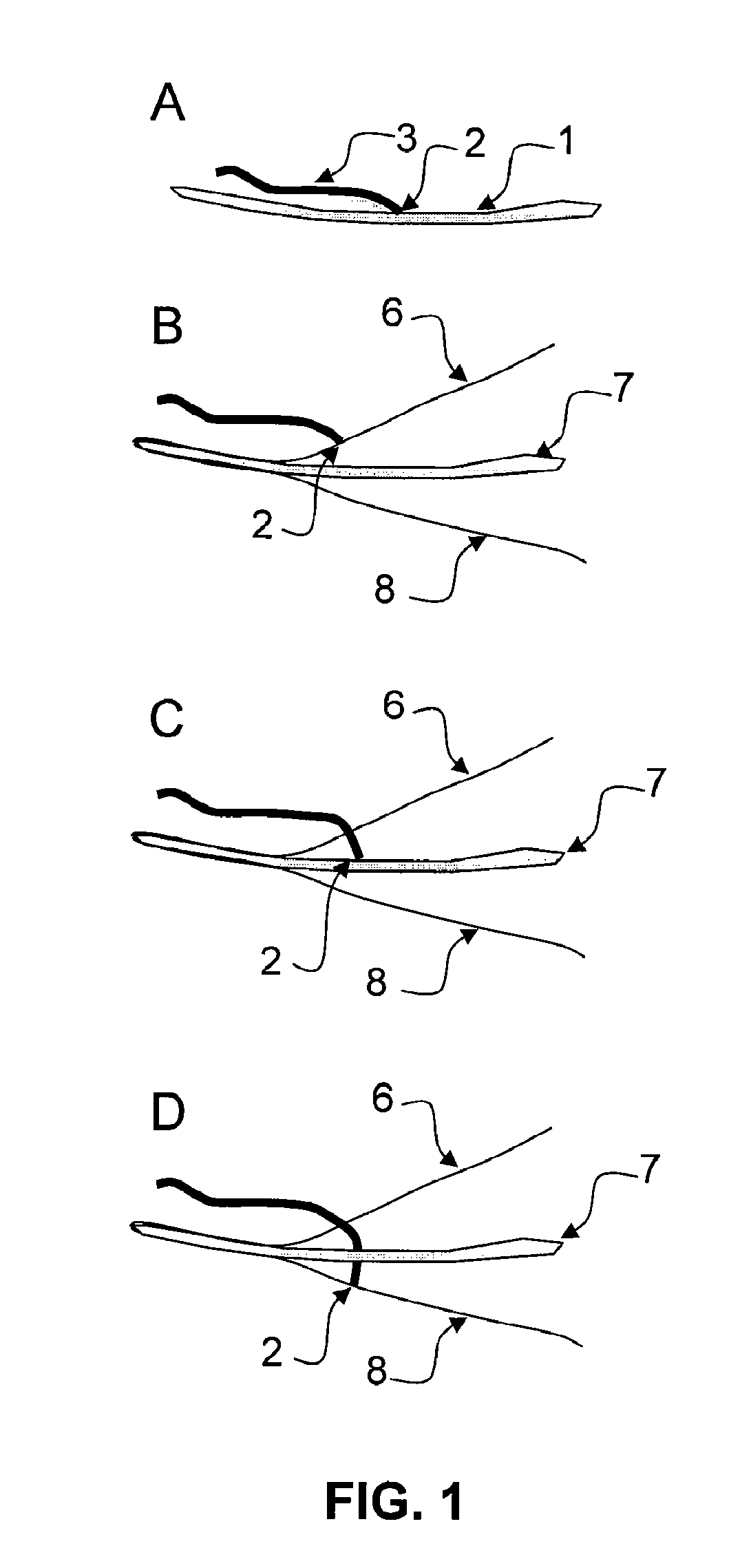 Sanitary Napkin with Braid