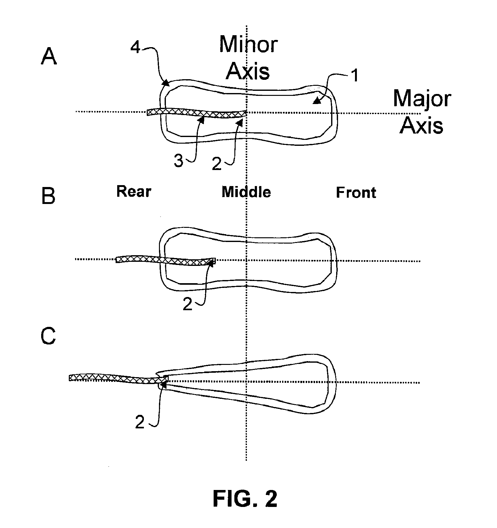 Sanitary Napkin with Braid