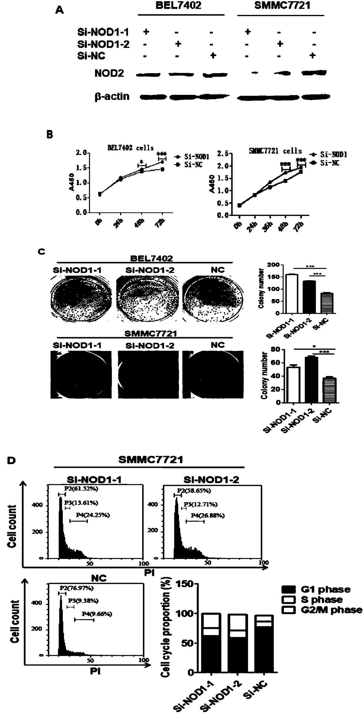 Application of NOD1 to preparation of products for inhibiting tumor SRC signal path