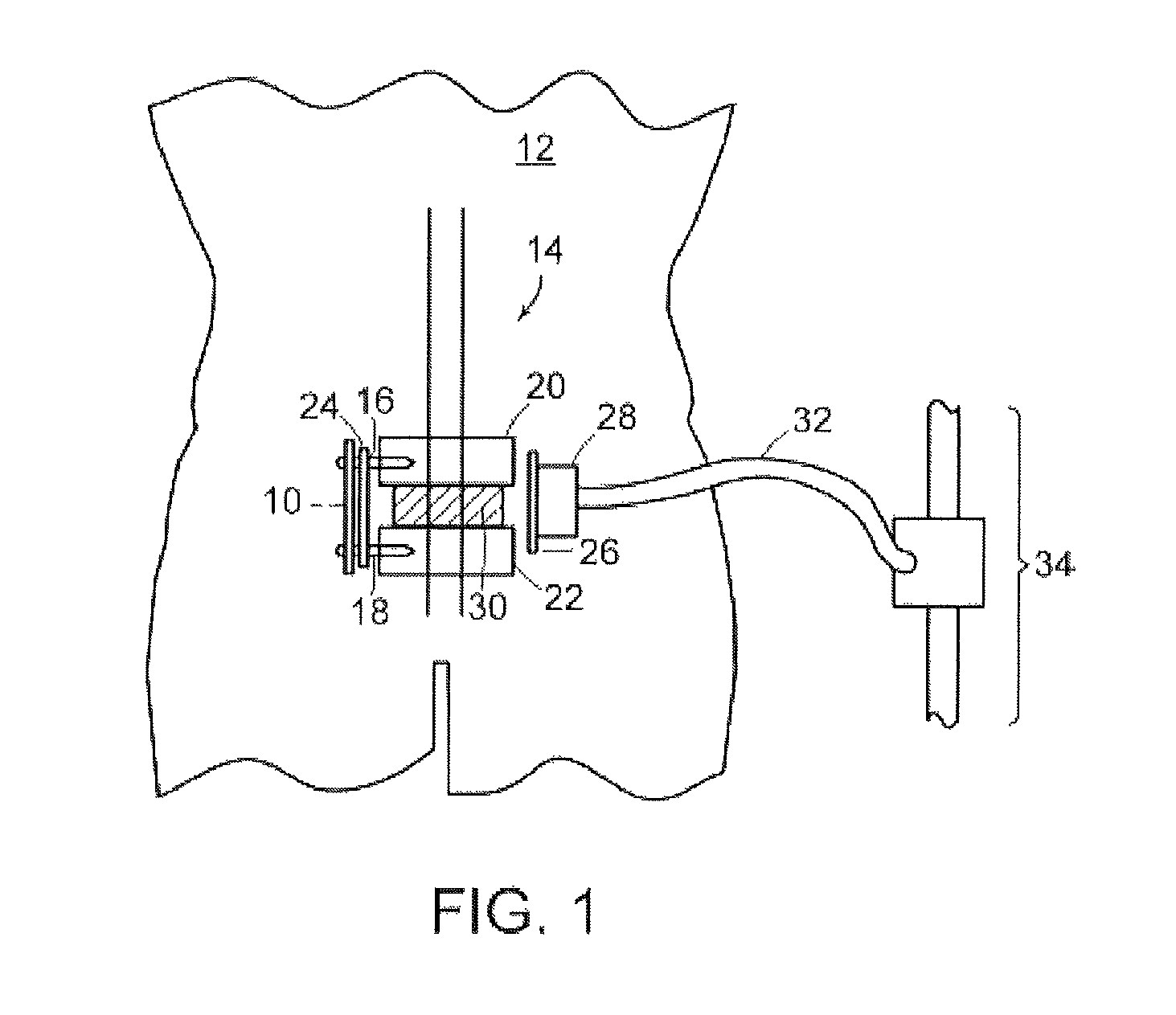 Surgical base unit and retractor support mechanism