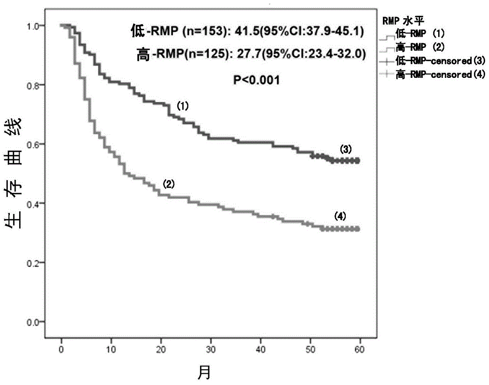 Application of rna polymerase ii fifth subunit regulatory protein in preparation of reagents for hepatocellular carcinoma prognosis or auxiliary tace prognosis