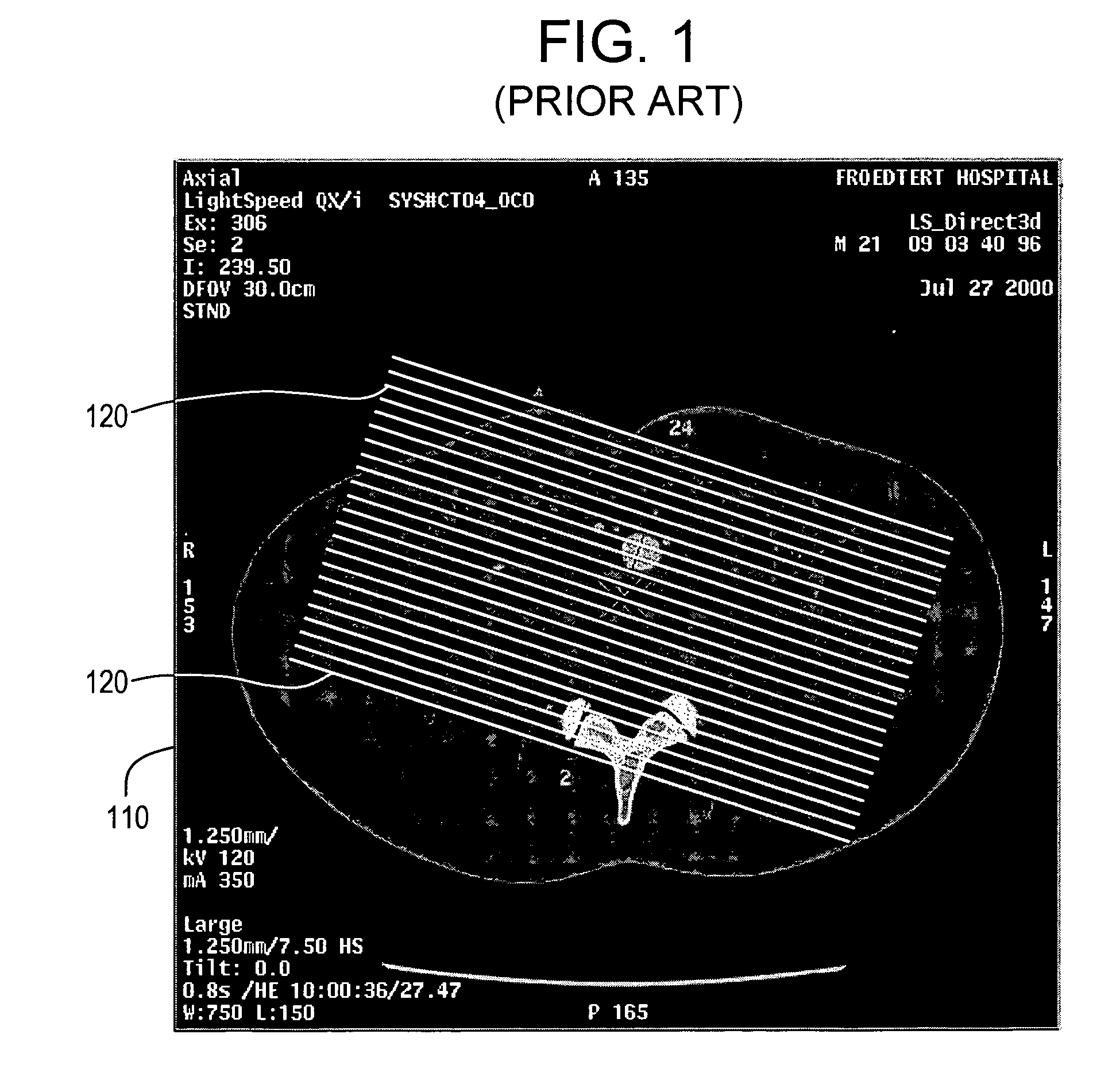 System and method for 3D graphical prescription of a medical imaging volume