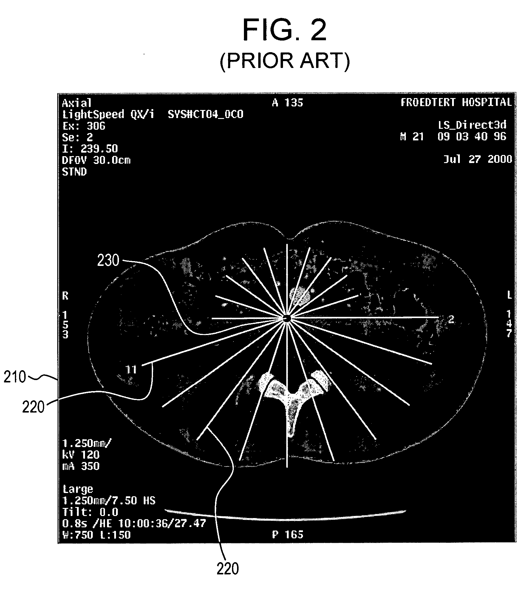 System and method for 3D graphical prescription of a medical imaging volume