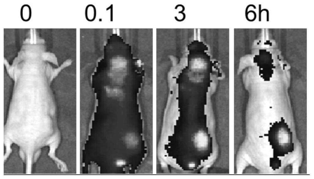 Diagnosis and treatment integrated apoptotic body and preparation method thereof