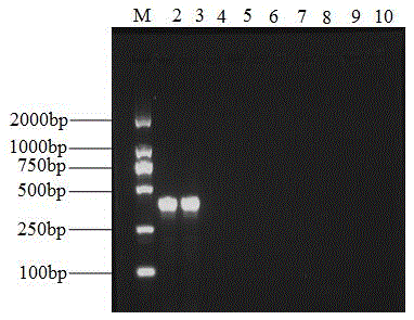 Phomopsis asparagi molecular detection primer and fast detection method
