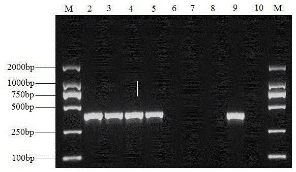 Phomopsis asparagi molecular detection primer and fast detection method