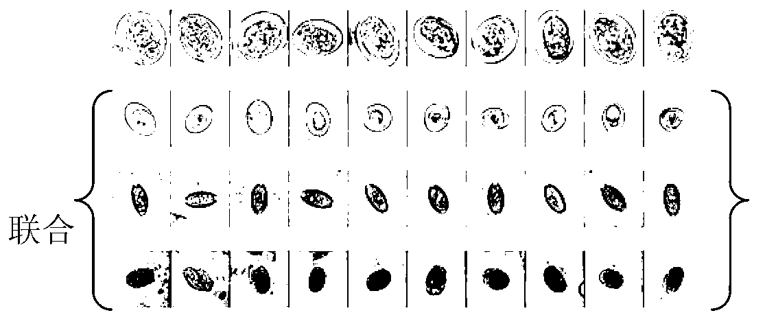 Parasite egg identifying method based on sparse representation