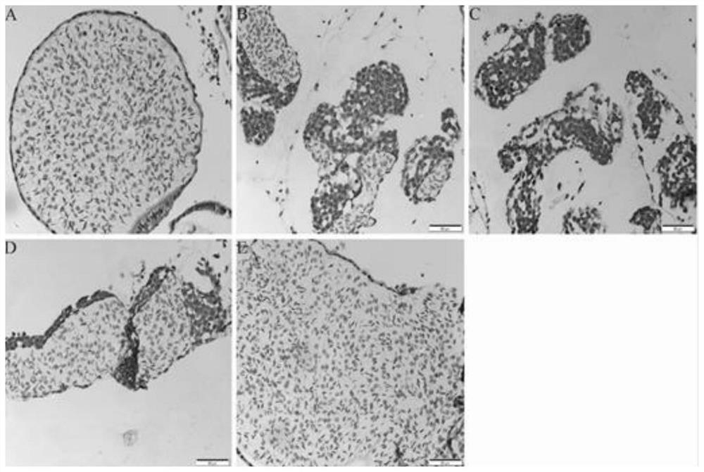 siRNA-IR sequence and application of male Macrobrachium rosenbergii sex transition