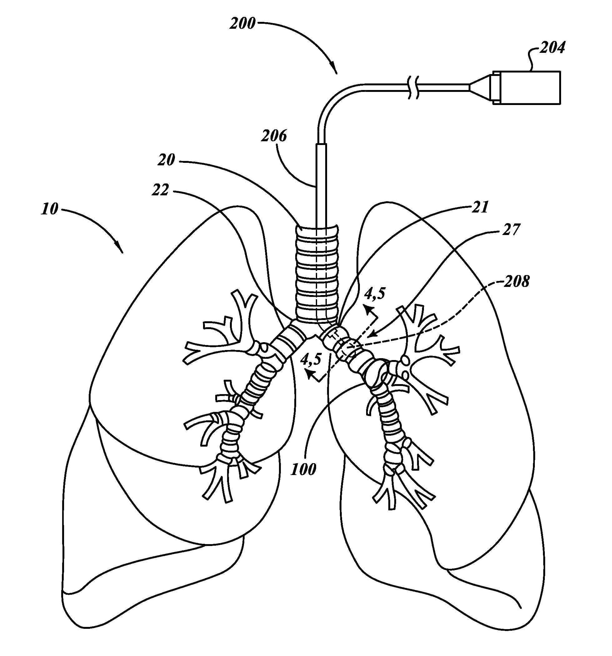 Delivery devices with coolable energy emitting assemblies