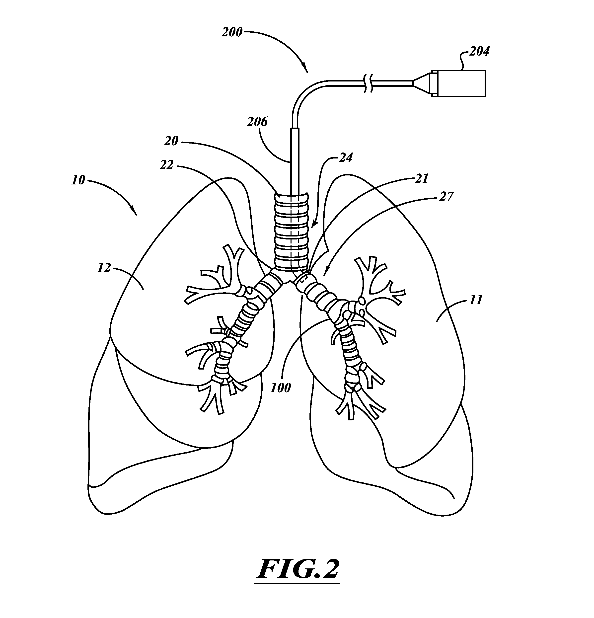 Delivery devices with coolable energy emitting assemblies