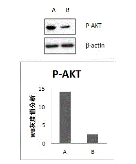 Method for detecting PTEN (Phosphatase and tensin homolog) gene and PI3K/AKT protein and application of method in cancer treatment