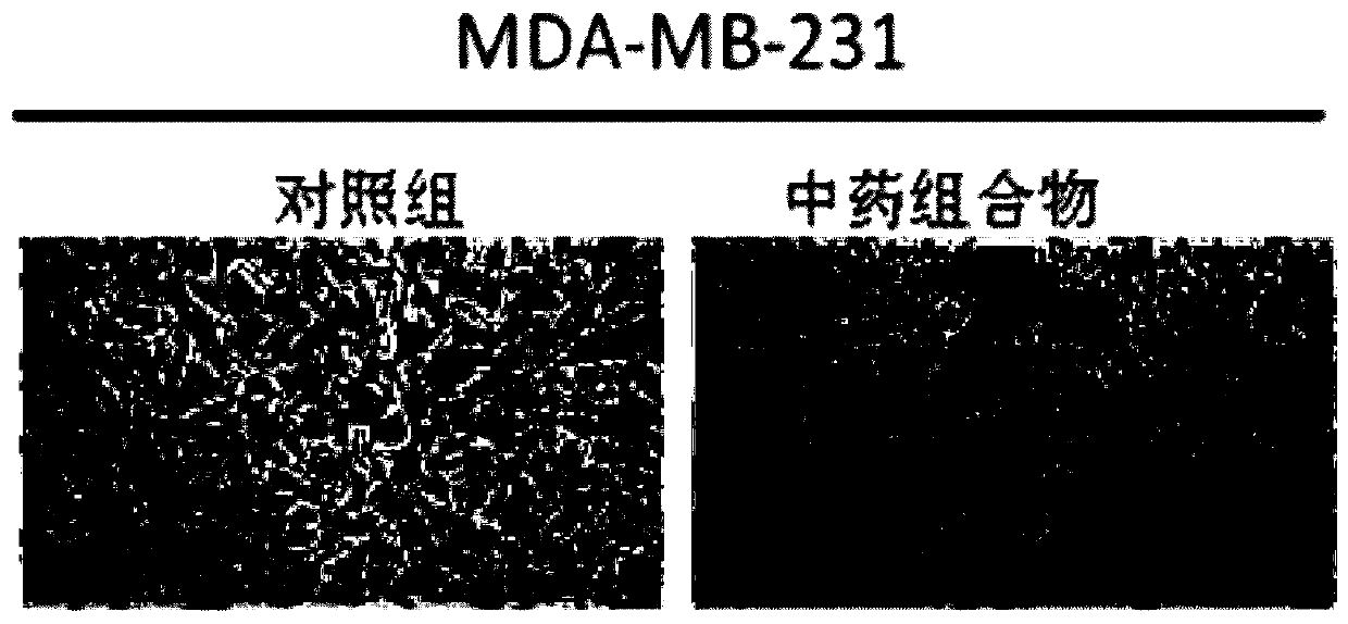 Traditional Chinese medicine composition capable of inhibiting tumor metastasis and preparation method and application thereof
