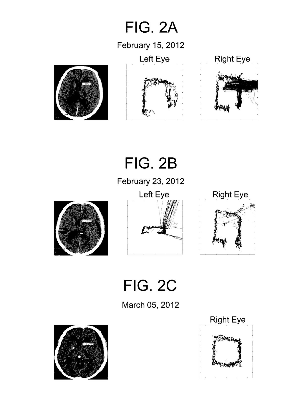 Methods and kits for assessing central nervous system integrity