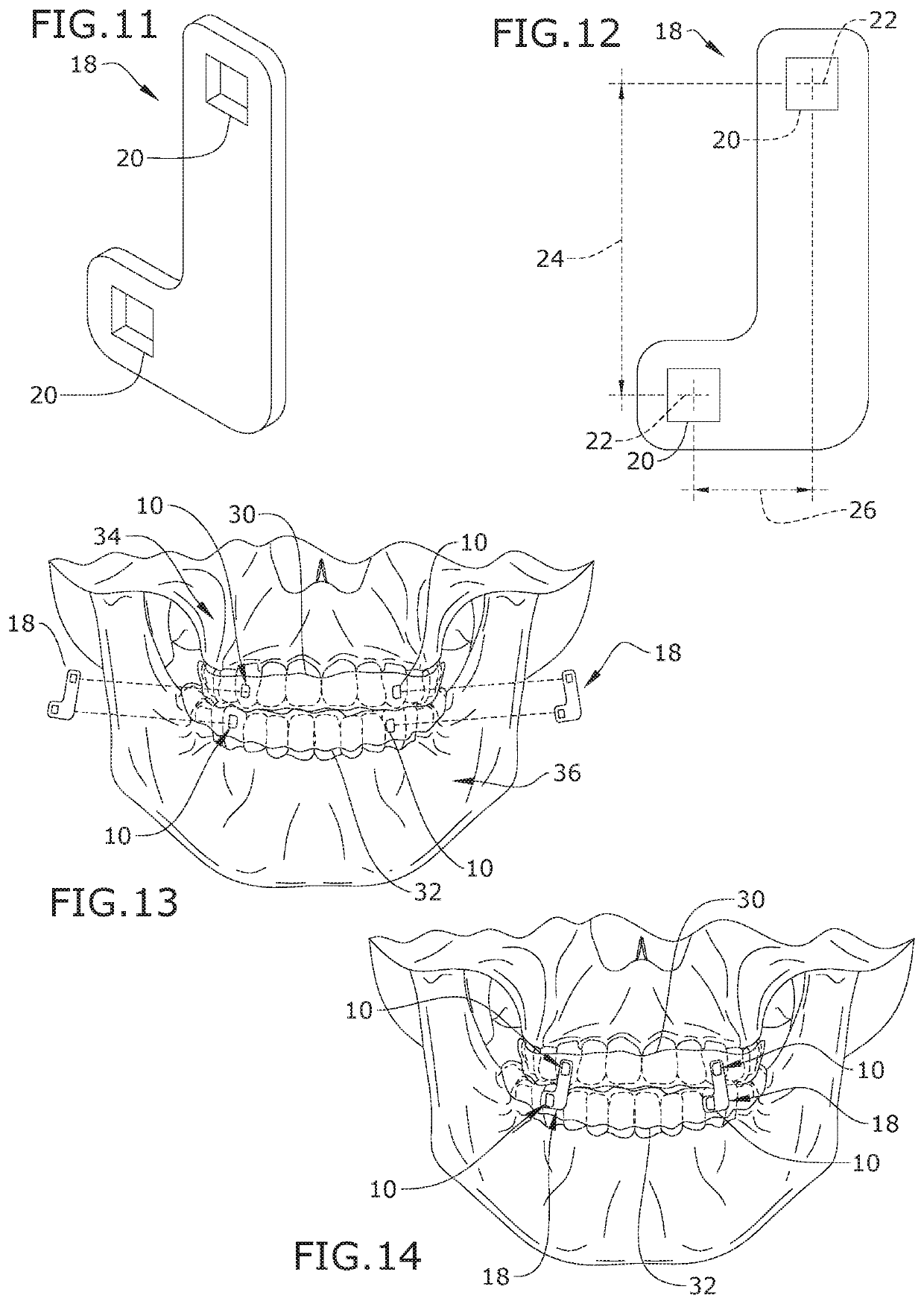 Apparatus and methods to convert dental, oral, orthodontic appliances, retainers, and dentures into a multifunctional oral appliance