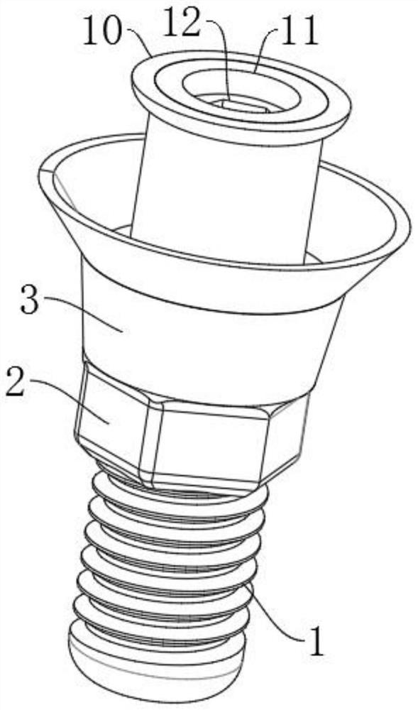 Adjustable universal composite abutment made of biomedical material and used for dental implant