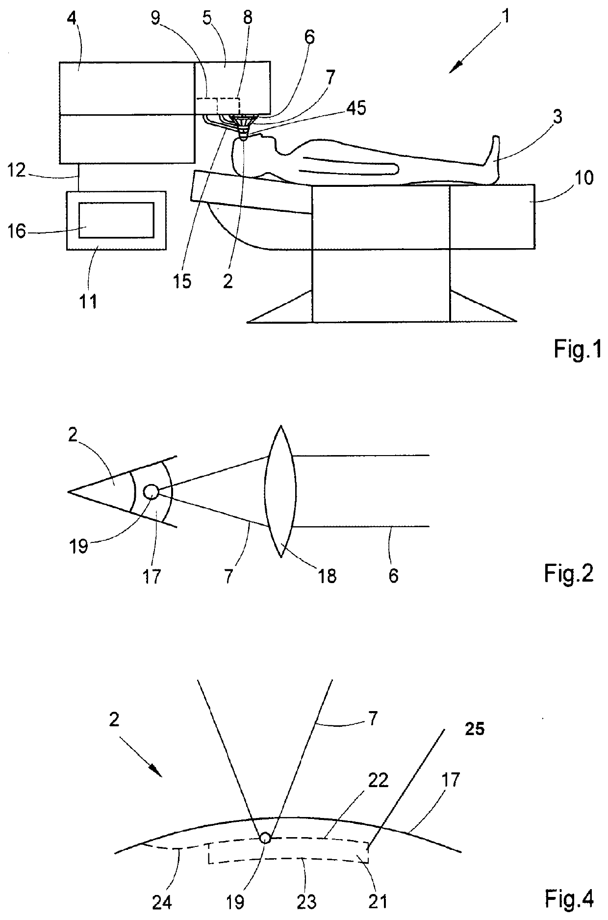 Eye-surgical treatment apparatus