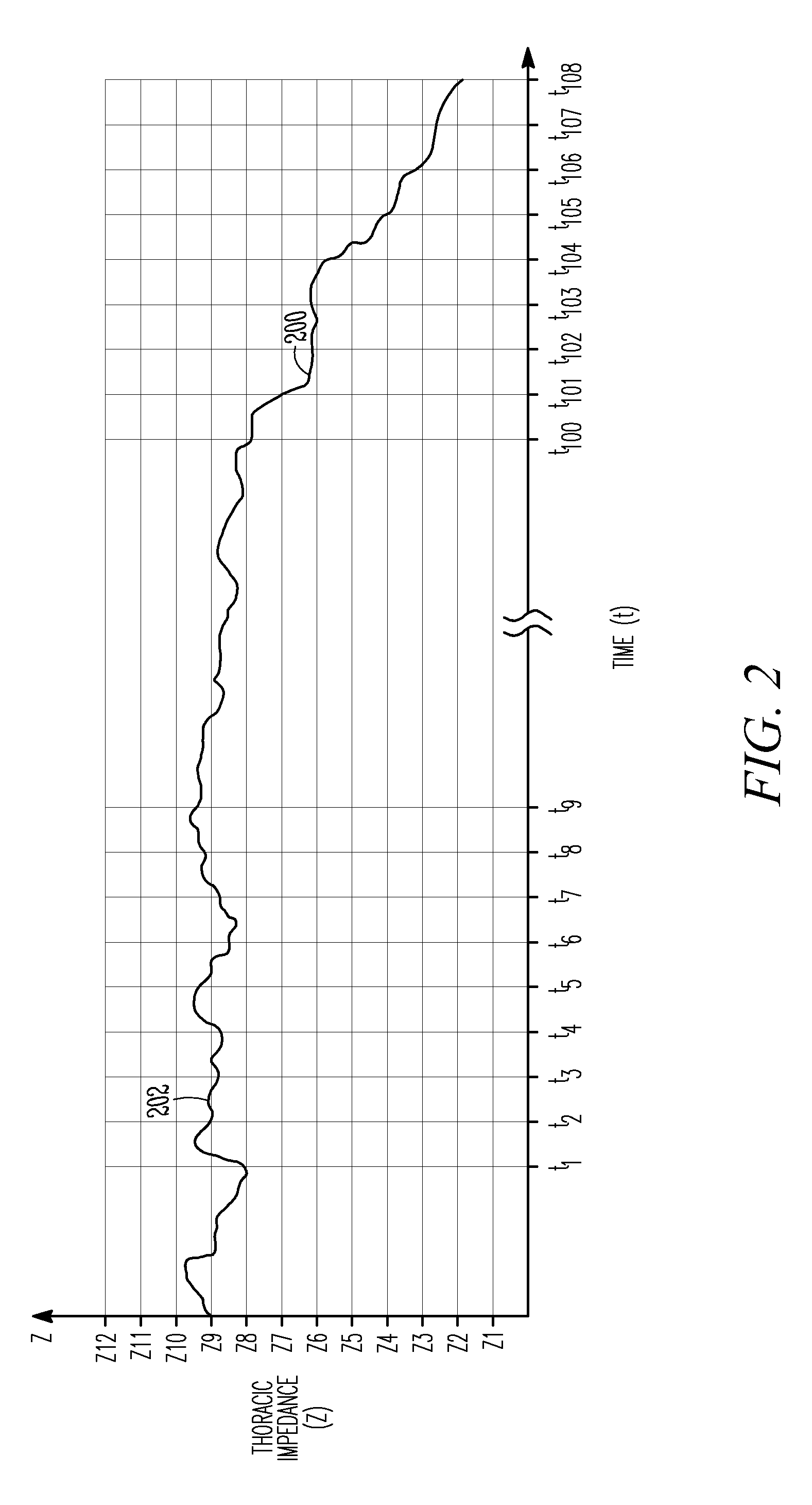 Monitoring fluid in a subject using an electrode configuration providing negative sensitivity regions