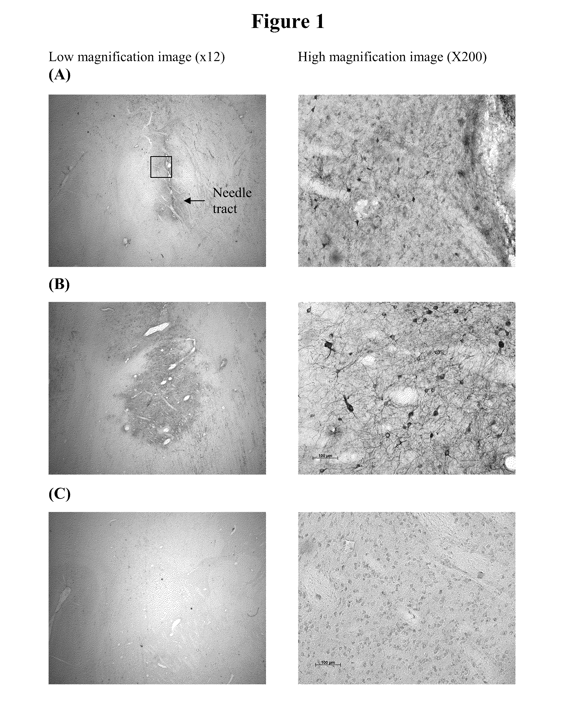 Method for vector delivery