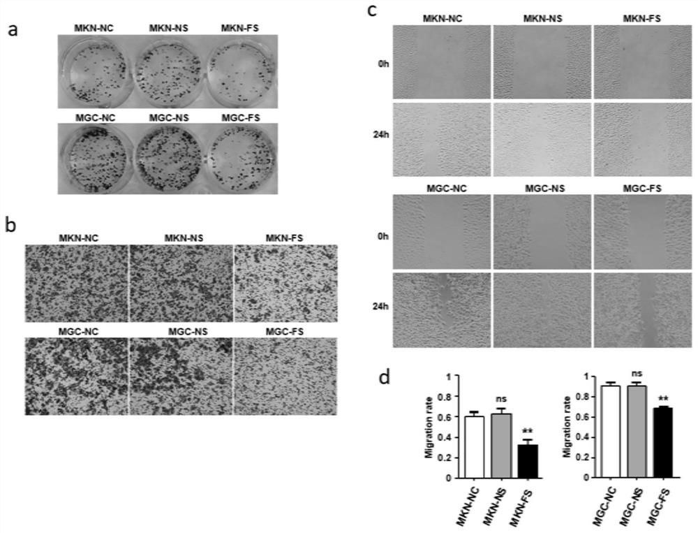 Application of FXYD3 as gastric cancer diagnosis marker and treatment target