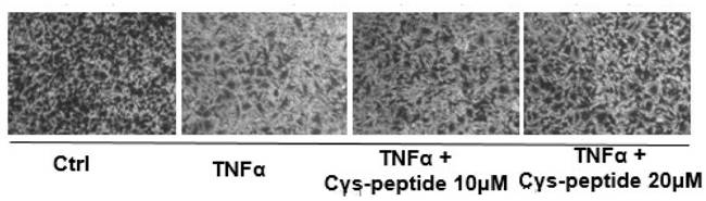 Application of a novel polypeptide for improving placental dysfunction in preeclampsia