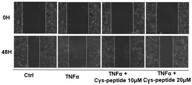 Application of a novel polypeptide for improving placental dysfunction in preeclampsia