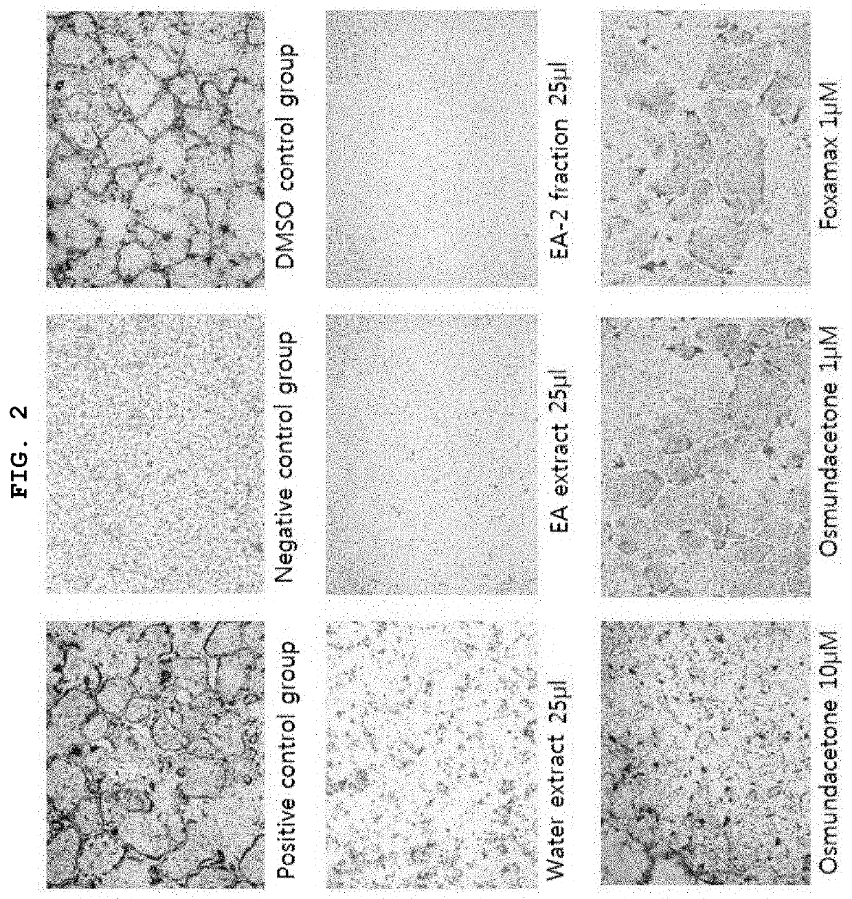 Composition comprising osmundacetone or pharmaceutically acceptable salt thereof for preventing or treating bone disease