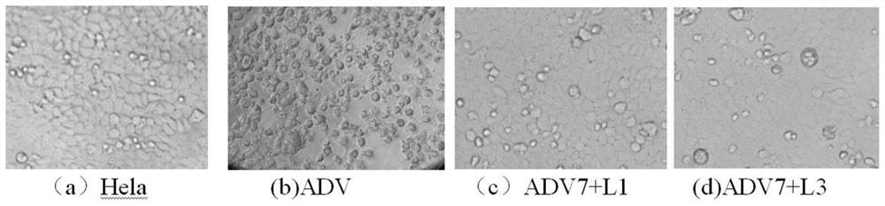 Monoiodobenzoic acid compounds and their application in anti-adv7 virus