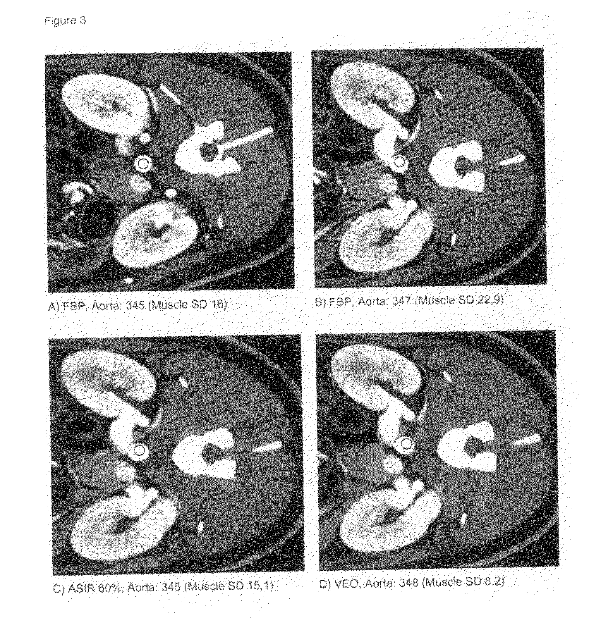 X-ray imaging contrast media with low iodine concentration and x-ray imaging process