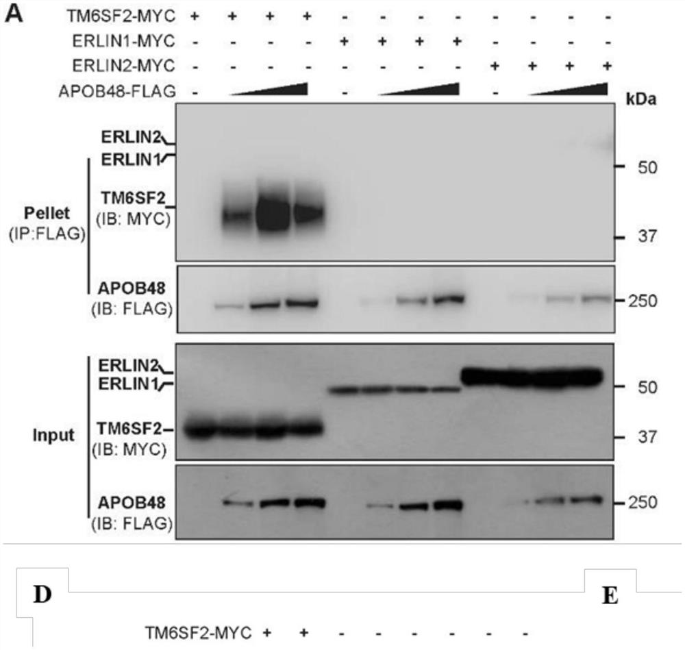 Applications of transmembrane protein, endoplasmic reticulum liporaft proteins or antagonists or inhibitors of coding genes thereof