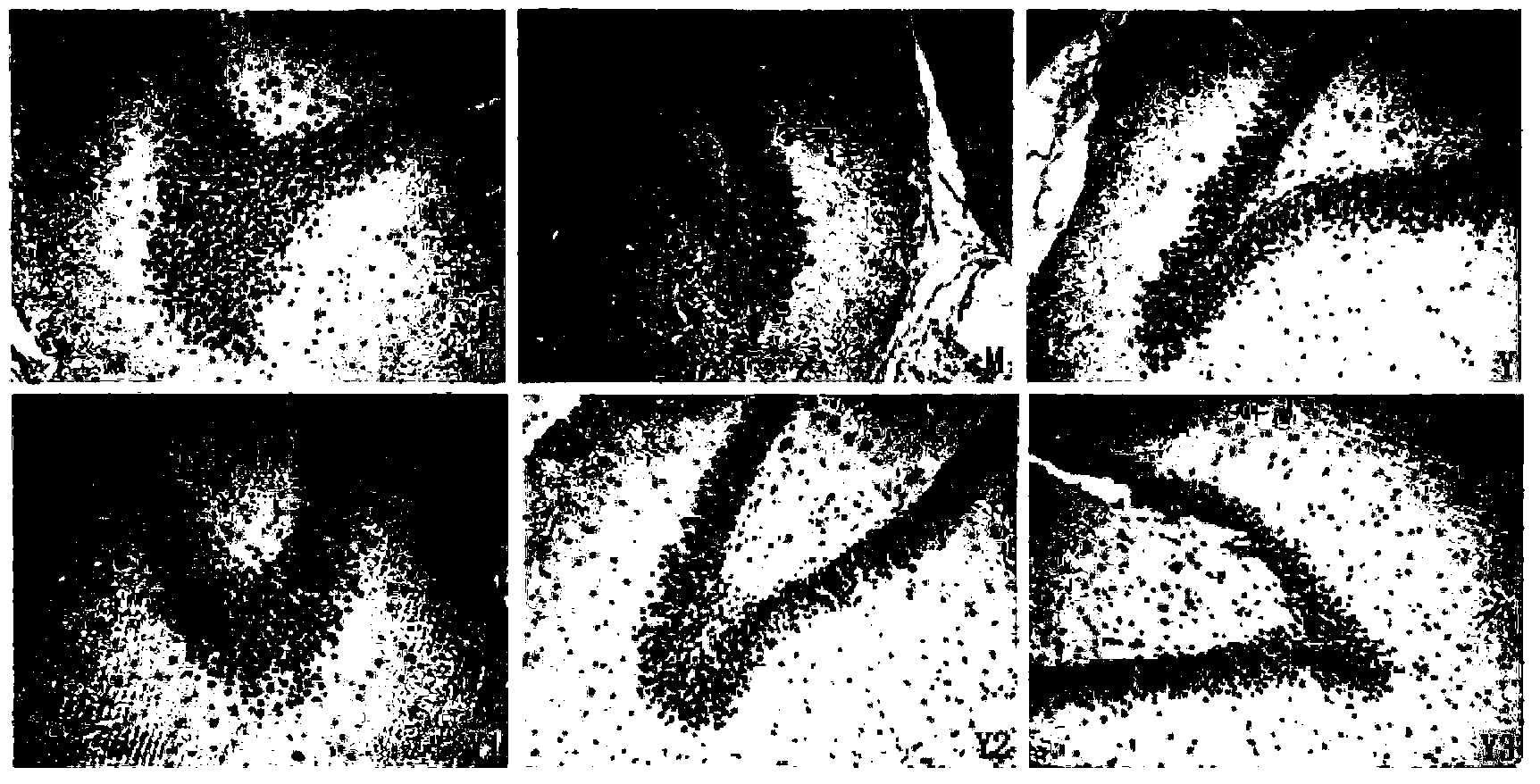 Application of pachysamine/pachysandrine G