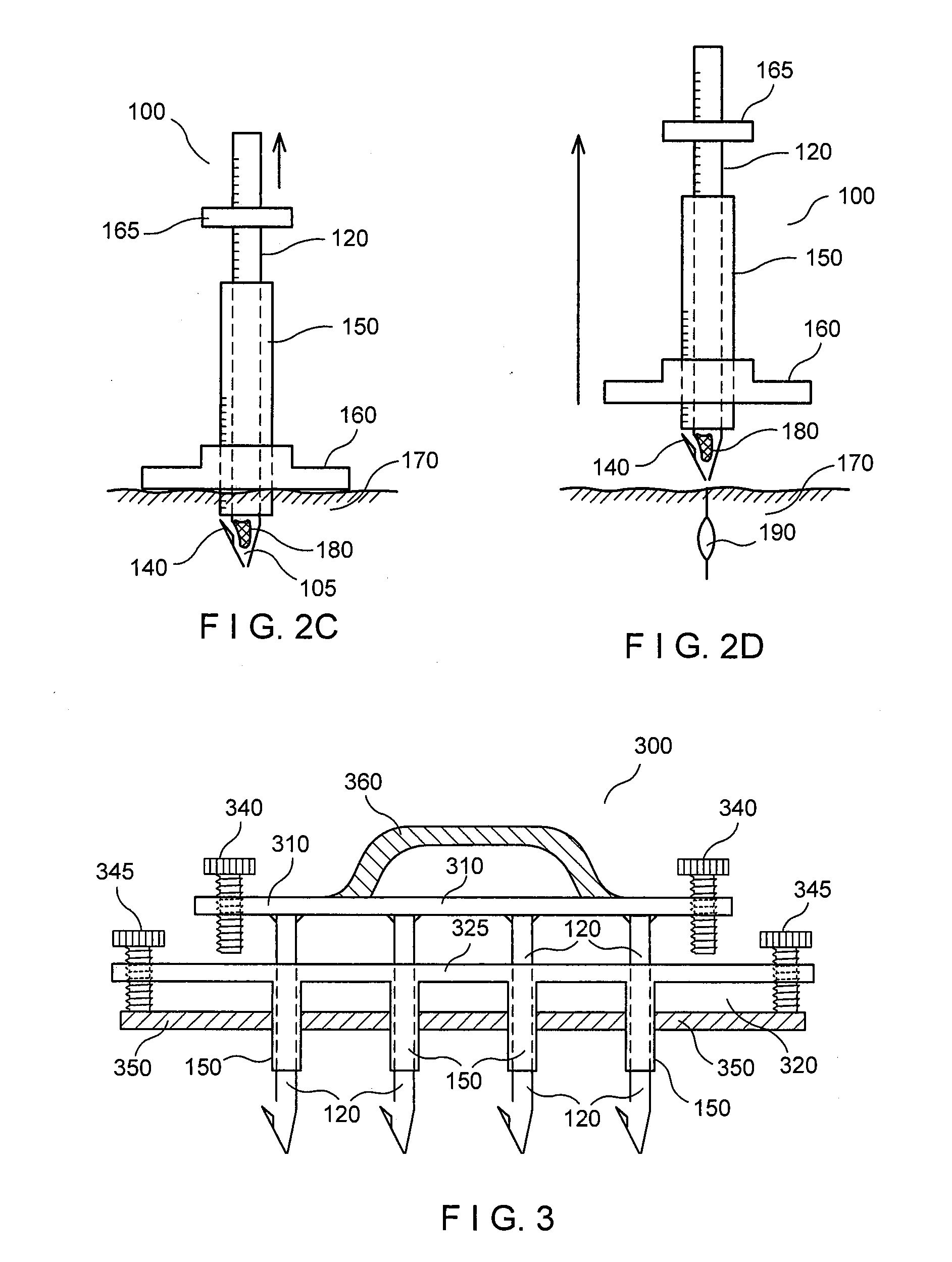 Method and apparatus for subsurface tissue sampling