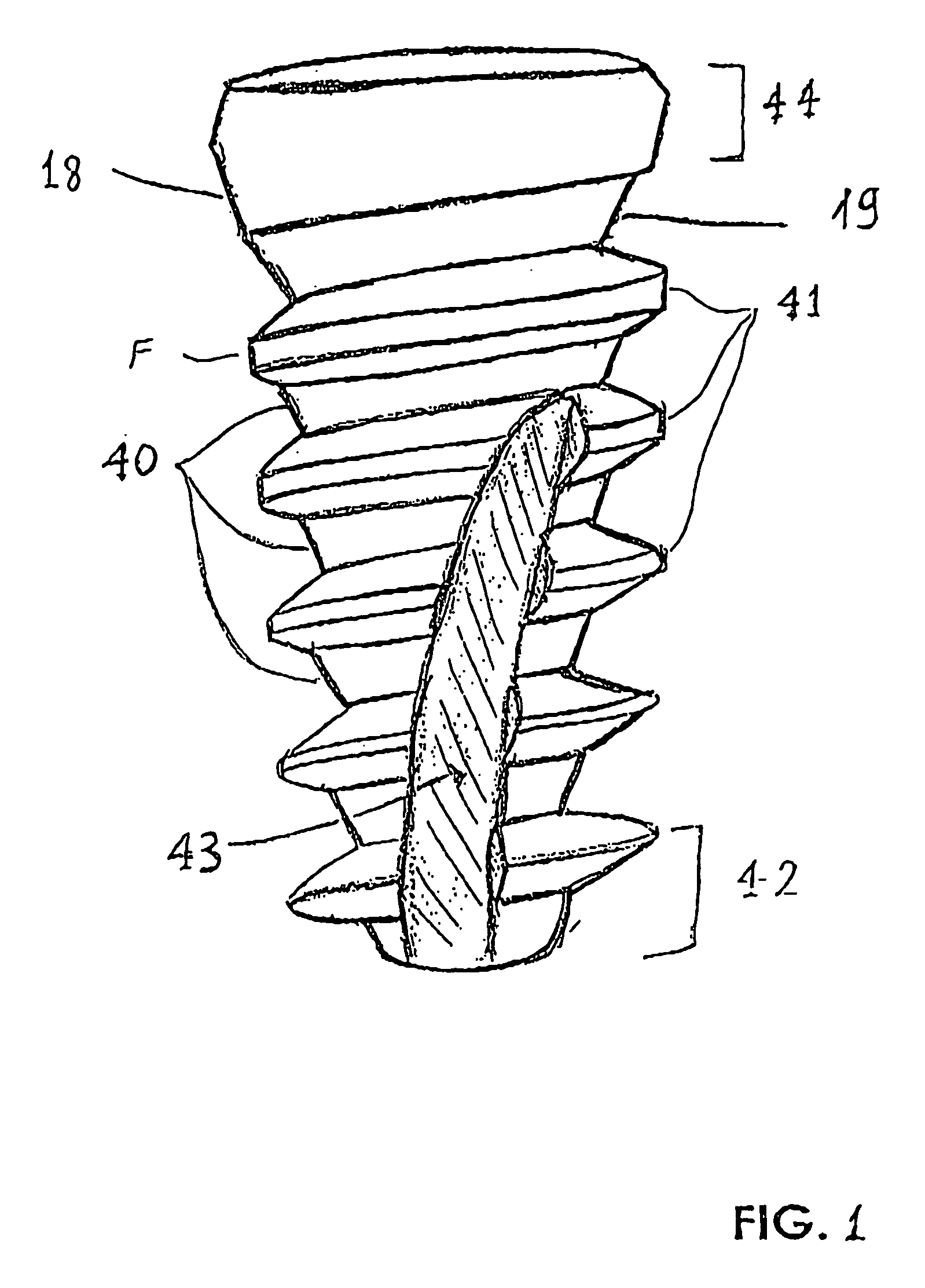 Condensing skeletal implant that facilitate insertions