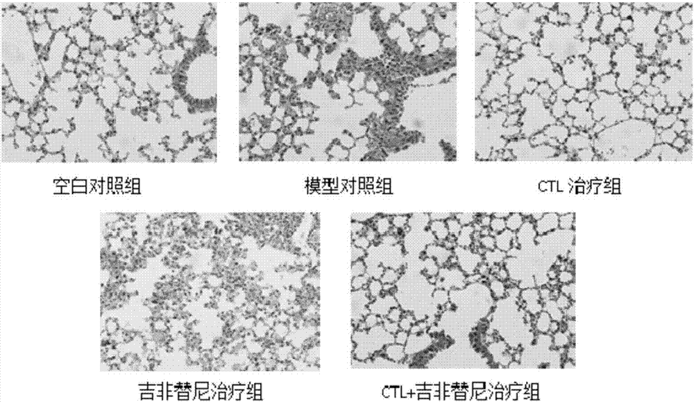 Antigen peptide T790M-6 and application to preparation of medicines for treating non-small cell lung cancer thereof