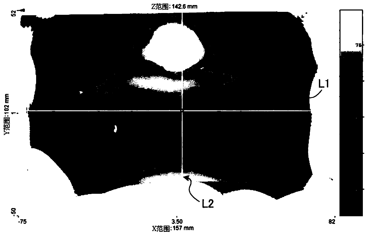 Gingivitis diagnosis assistance device and gingivitis diagnosis assistance system