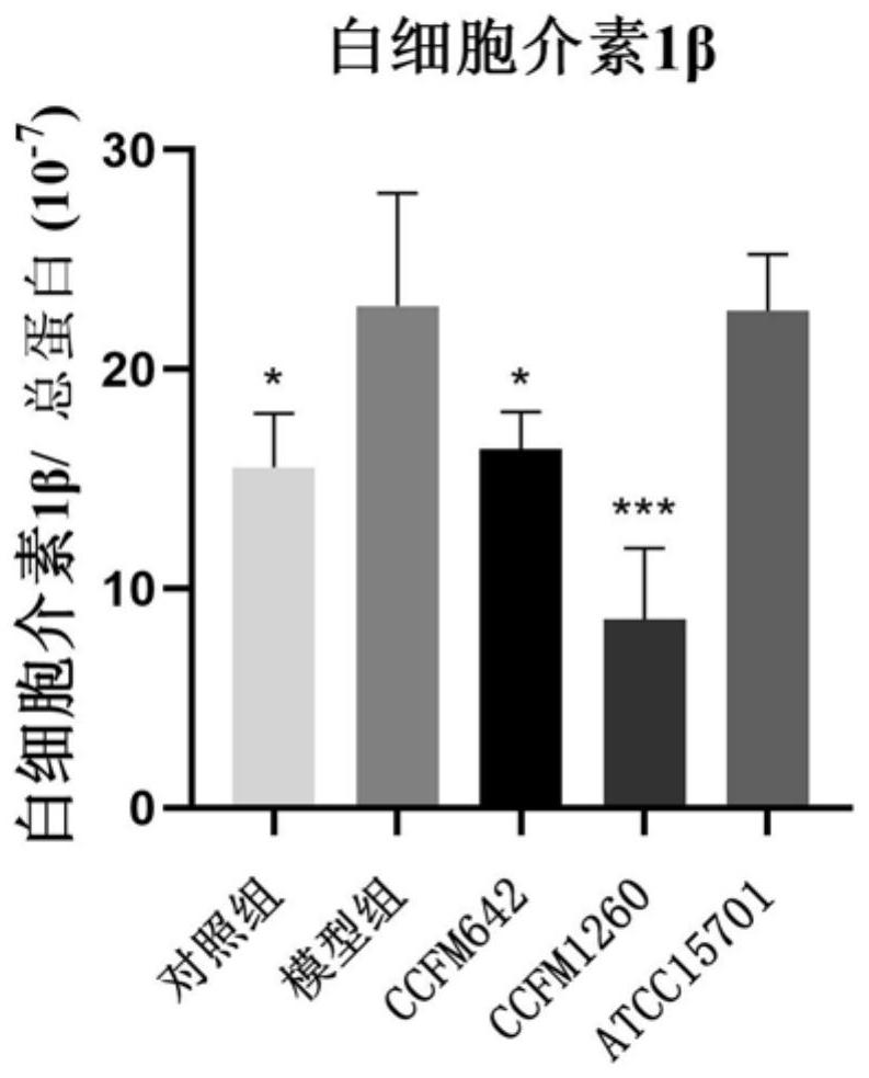 Bifidobacterium breve capable of down-regulating IL-17 and relieving constipation and application of bifidobacterium breve