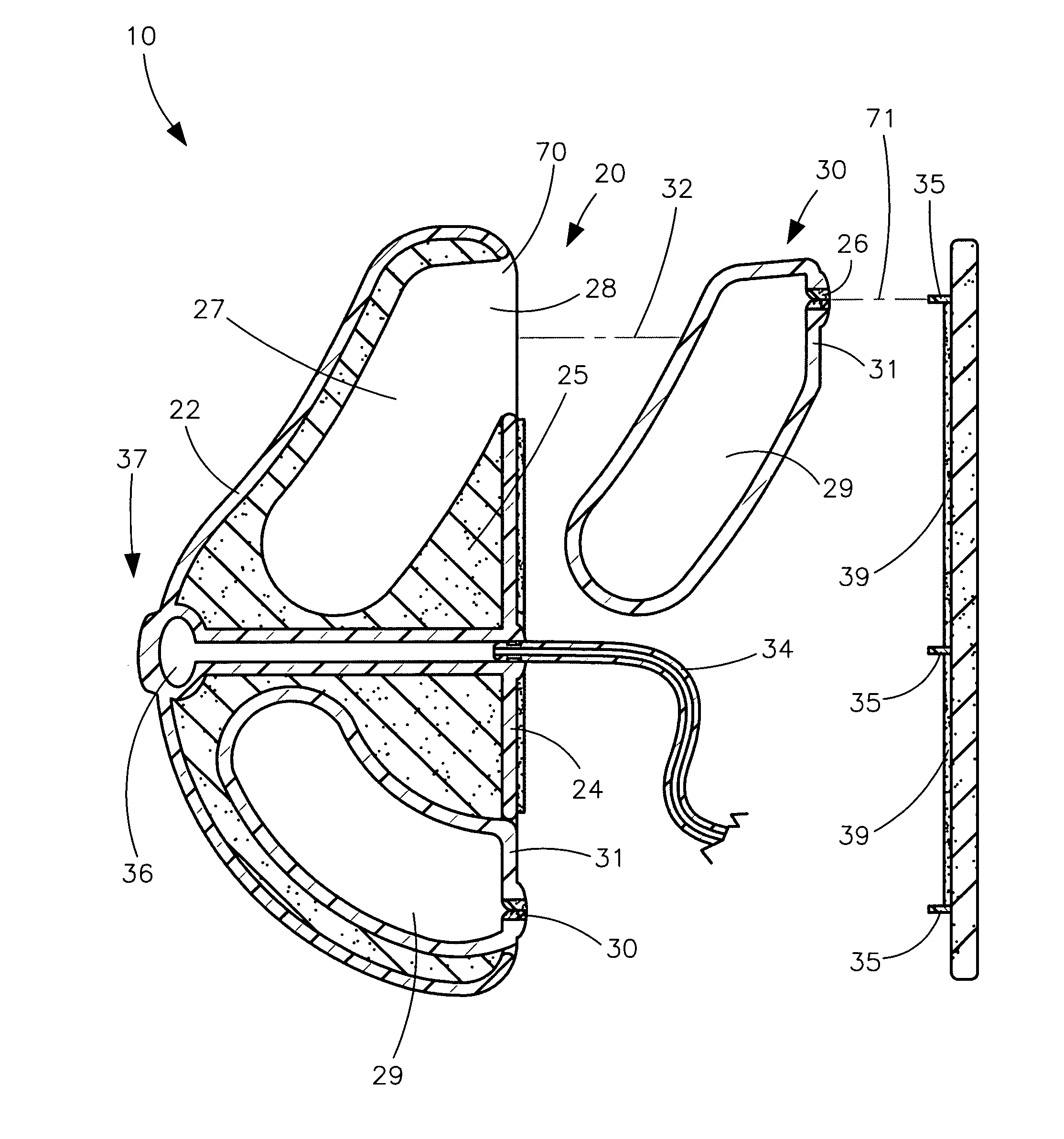 Inflatable prosthetic breast assembly and associated method